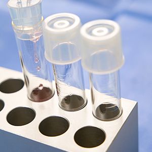 Extraccions analítiques a domicili<