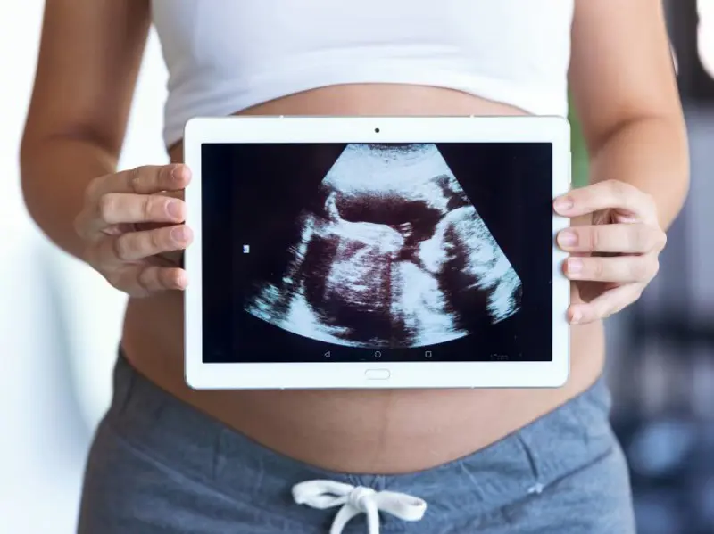 Cribatge prenatal no invasiu en sang materna
