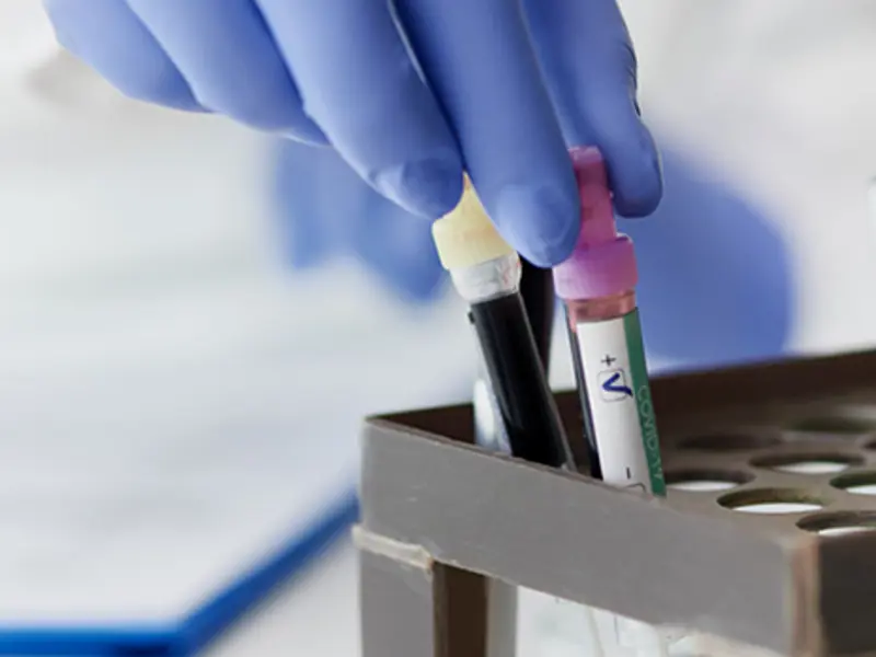 Detecció d’helicobacter Pylori en alé